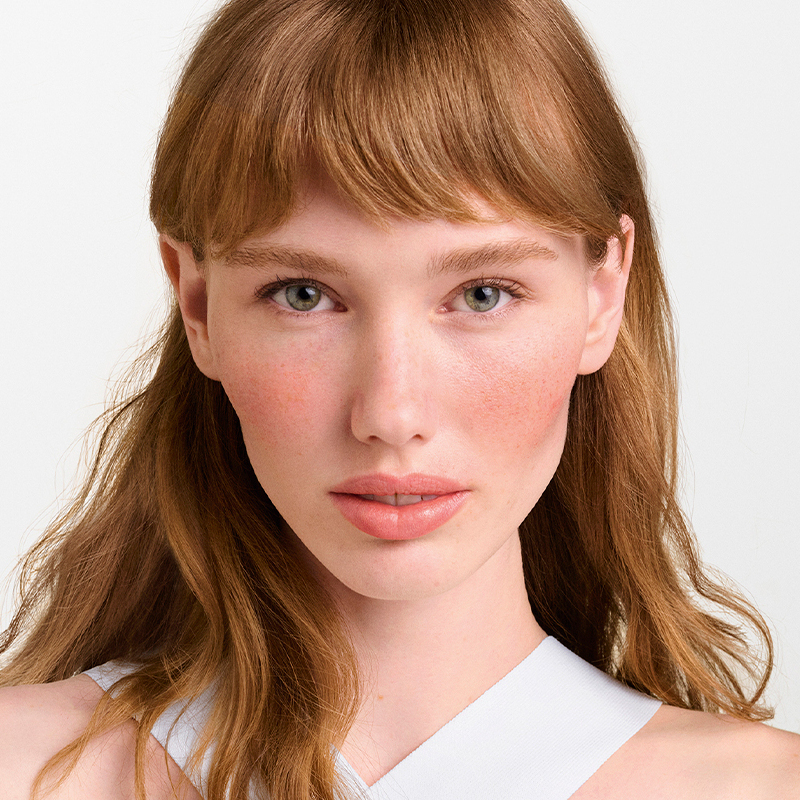 Mulher com leve vermelhidão facial