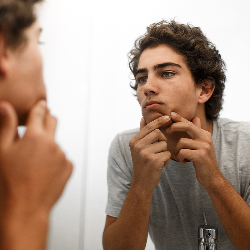 adolescente com espinhas na frente do espelho