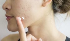 your-skin_sebium-sensitive_How-do-you-treat-acne-prone-skin